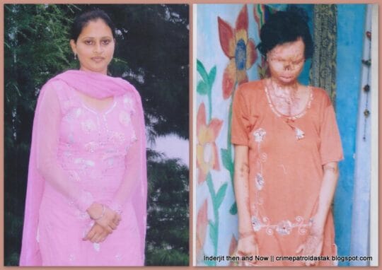 Crime Patrol | Acid Attack Victim Rashmi Kaur (Inderjit Kaur) fights for justice (Episode 267, 268 on 6th, 7th July 2013)